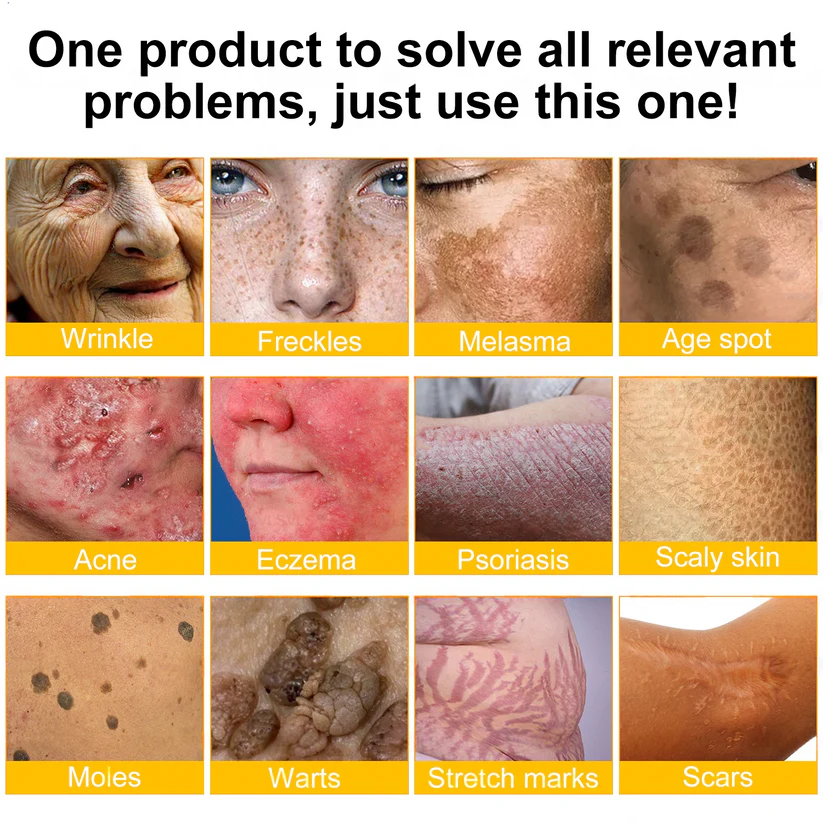 👨‍⚕️Dermatologist Recommended👨‍⚕️: Bee Venom · Botox Advanced Skin Rescue — Specifically Formulated for Paper-Thin, Fragile & Easy-Bruising Skin