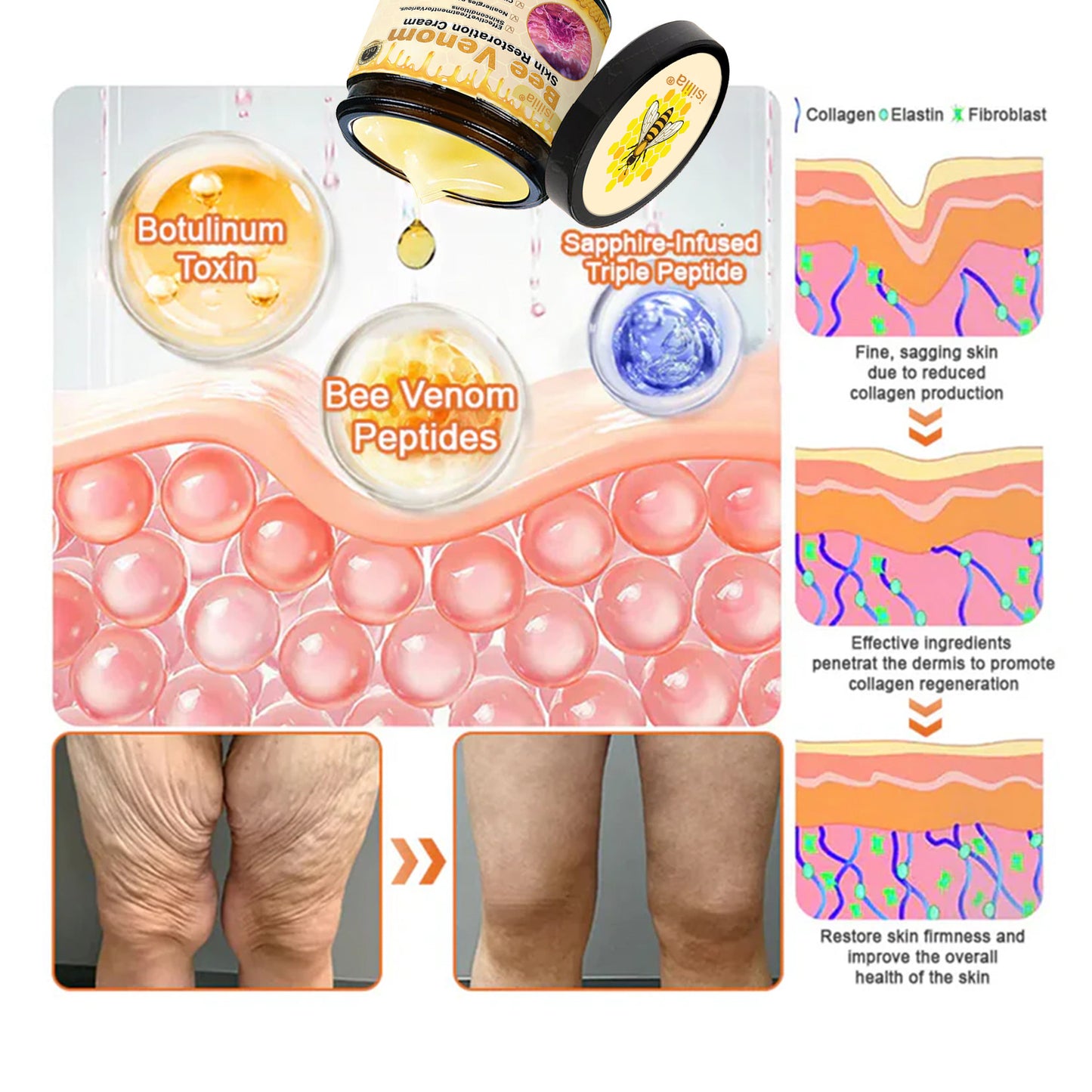 👨‍⚕️Dermatologist Recommended👨‍⚕️: Bee Venom · Botox Advanced Skin Rescue — Specifically Formulated for Paper-Thin, Fragile & Easy-Bruising Skin