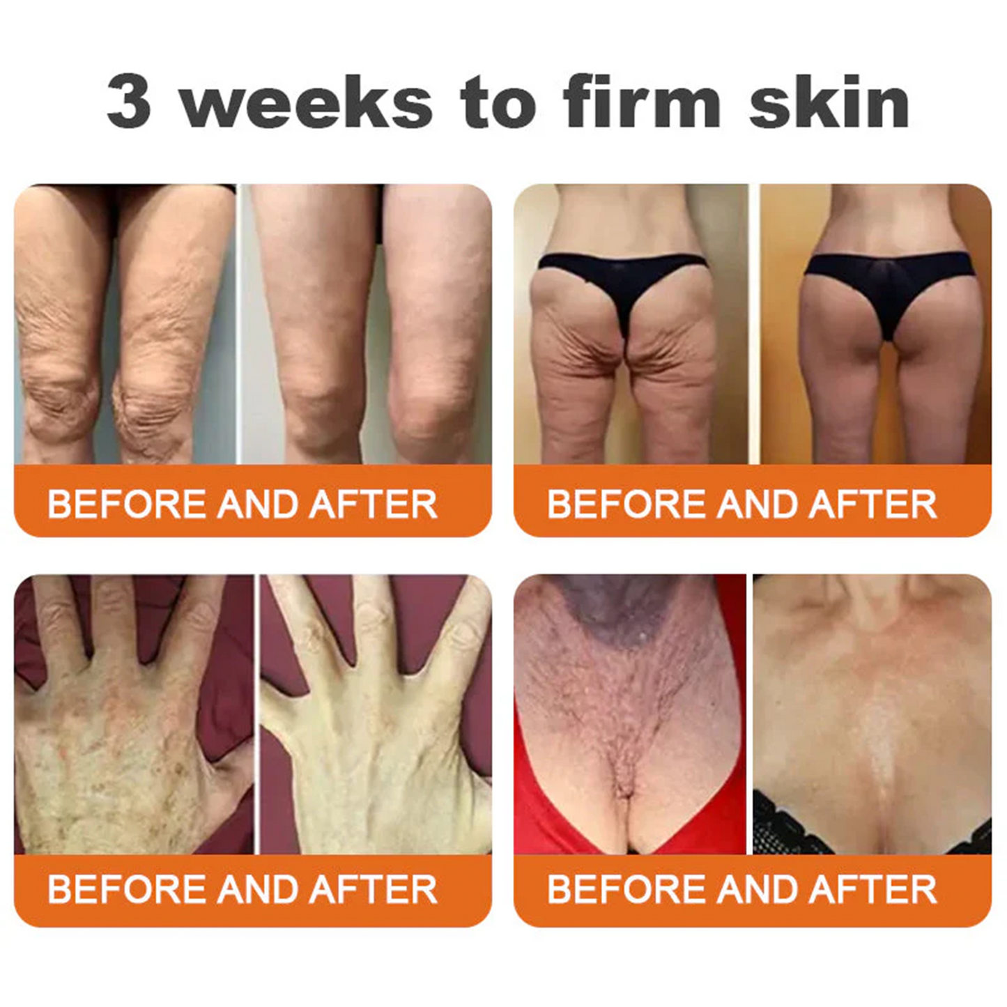 🍈💫(Made in USA)💎FDA Approved: Rolimey® Bee venom peptides+botox Pro Comprehensive Cream —Tightening for Skin Types 🔥