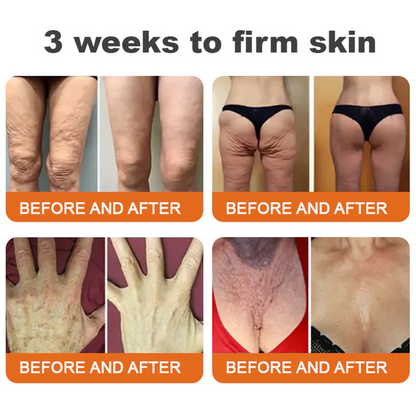👨‍⚕️Dermatologist Recommended👨‍⚕️: Bee Venom · Botox Advanced Skin Rescue — Specifically Formulated for Paper-Thin, Fragile & Easy-Bruising Skin