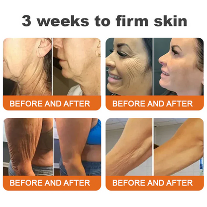 👨‍⚕️Dermatologist Recommended👨‍⚕️: Bee Venom · Botox Advanced Skin Rescue — Specifically Formulated for Paper-Thin, Fragile & Easy-Bruising Skin