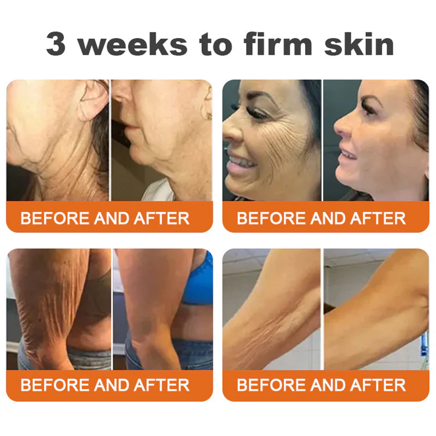 🍈💫(Made in USA)💎FDA Approved: Rolimey® Bee venom peptides+botox Pro Comprehensive Cream —Tightening for Skin Types 🔥