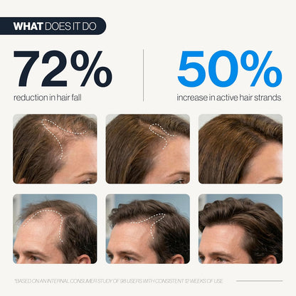 🍃💫(Made in USA)- Celsiora® Advanced peptides Hair Density Roll-On Serum| Scalp Serum for Reduced Hair Fall | Men & Women