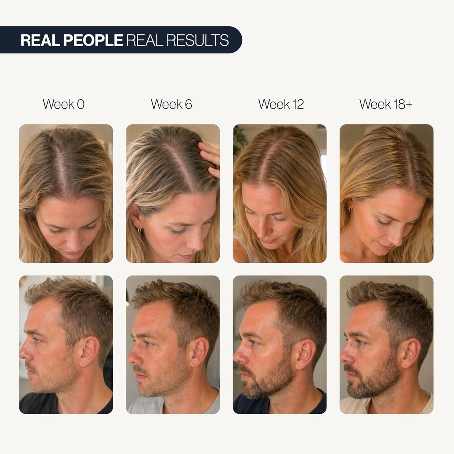 🍃💫(Made in USA)- Celsiora® Advanced peptides Hair Density Roll-On Serum| Scalp Serum for Reduced Hair Fall | Men & Women