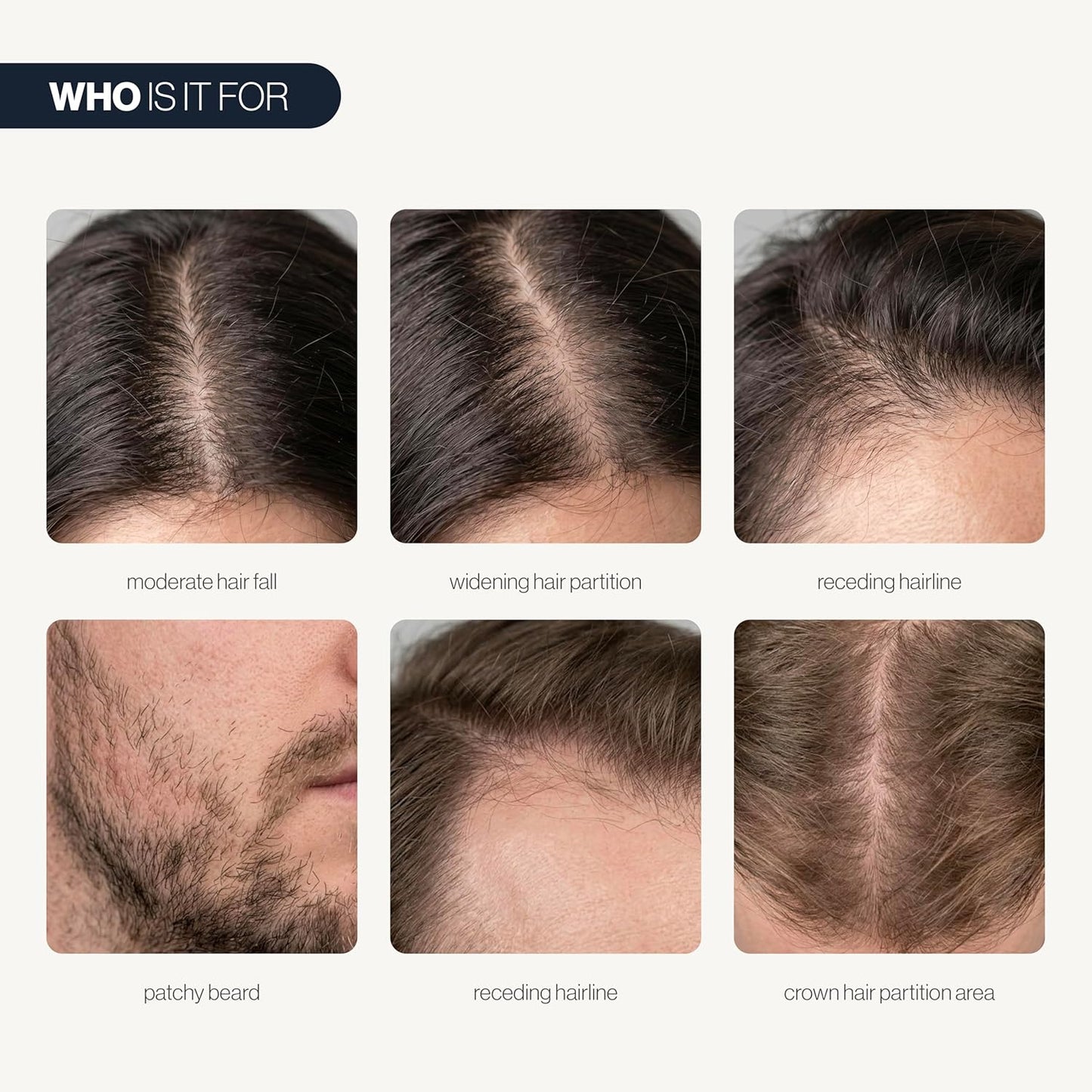 🍃💫(Made in USA)- Celsiora® Advanced peptides Hair Density Roll-On Serum| Scalp Serum for Reduced Hair Fall | Men & Women