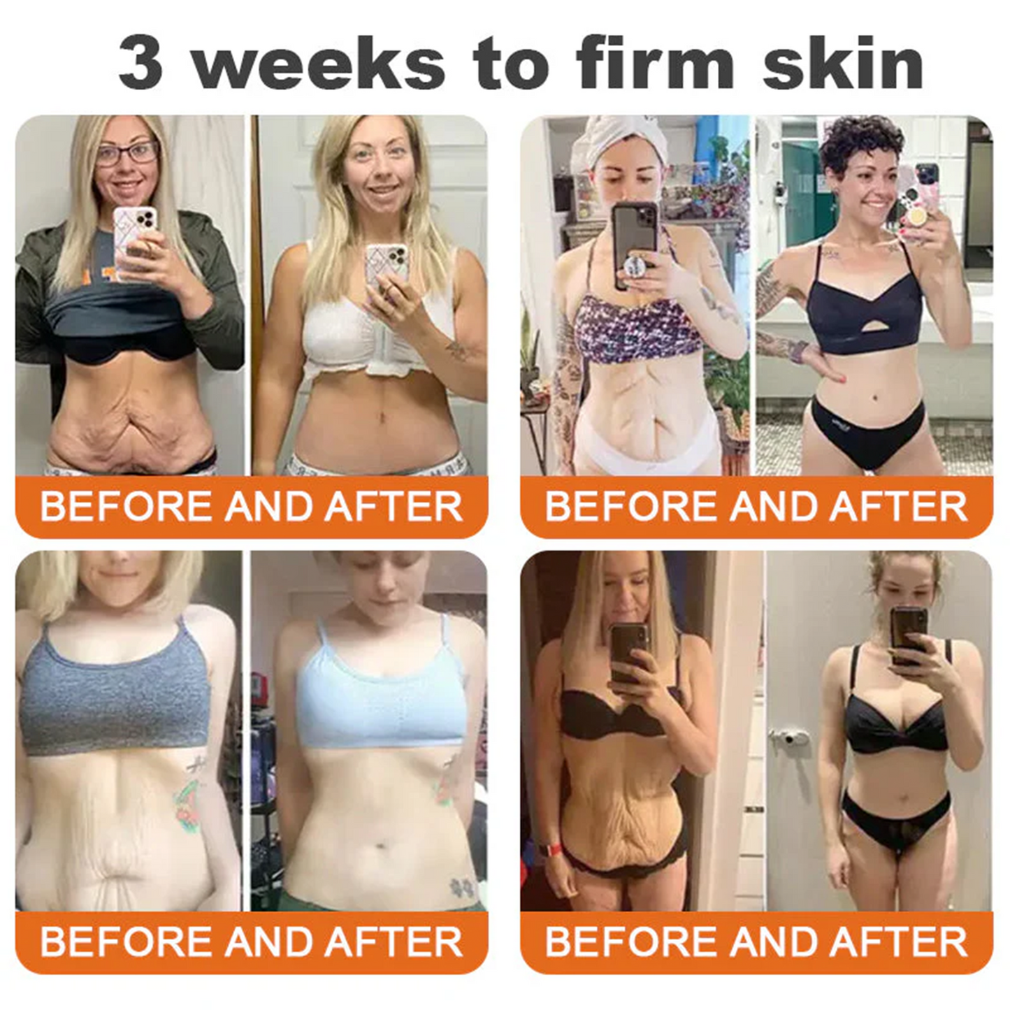 👨‍⚕️Dermatologist Recommended👨‍⚕️: Bee Venom · Botox Advanced Skin Rescue — Specifically Formulated for Paper-Thin, Fragile & Easy-Bruising Skin