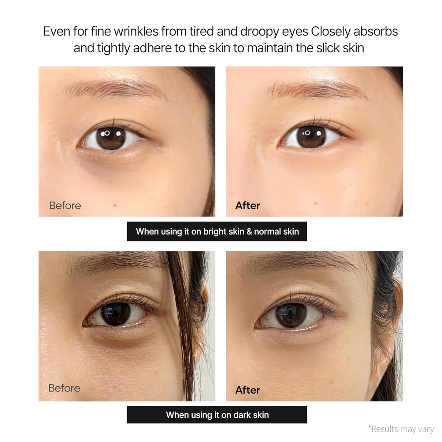 🎁💫Save 40% for adding the second one- Calcium Dark Spot Eye Cream 15g – Niacinamide & Calcium Gluconate Eye Cream for Dark Circles, Under Eye Bags & Sagging | Hydrolyzed Elastin EX Volume Firming